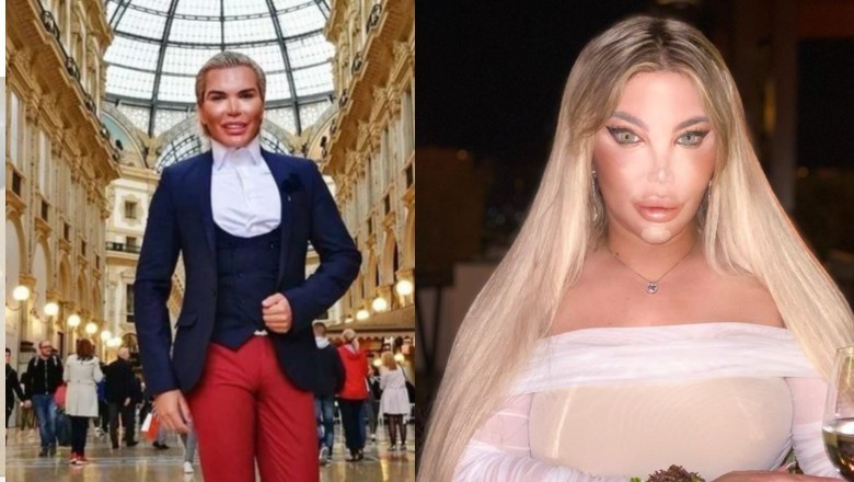 „Żywy Ken” postanowił zostać „Żywą Barbie” Kolejne operacje i zmiana płci