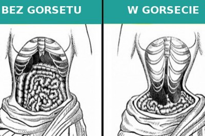 9 dziwacznych trendów mody z epoki wiktoriańskiej. Moda ważniejsza od zdrowia