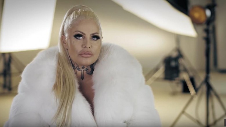 Kasia z „Królowych życia” ma nową twarz. Chwali się kolejnymi operacjami