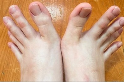 Chwalą się zdjęciami swoich niezwykłych cech fizycznych w które, aż trudno uwierzyć 