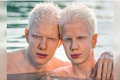 Ci ludzie zostali obdarzeni magnetyczną aparycją. Trudno oderwać od nich wzrok