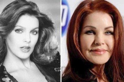 Te gwiazdy całkiem zatraciły się w operacjach plastycznych. Stracili ludzki wygląd