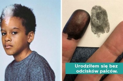 18 zdjęć osób których geny wyposażyły w  unikalne cechach wyglądu