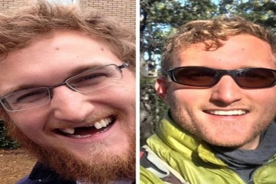 20 osób, które podjęły walkę o nowy wizerunek. Ich metamorfozy inspirują 