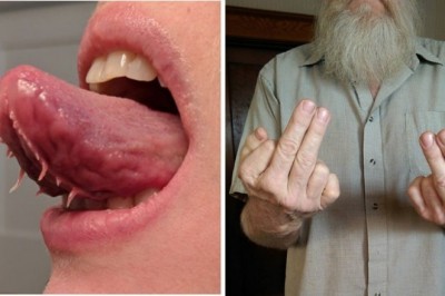 Cechy genetyczne tych ludzi należą do najbardziej wyjątkowych i rzadkich