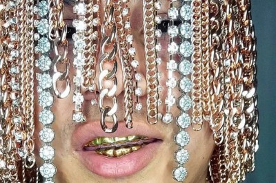 Szalona metamorfoza rapera Zamiast włosów wszczepił sobie złote łańcuchy. 