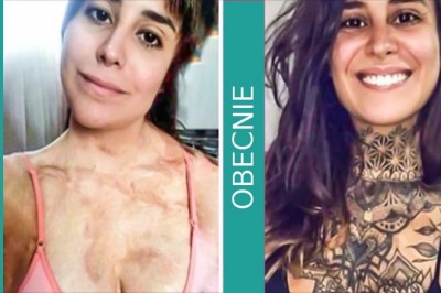 16 silnych osób, które uporem pokonały przeciwności losu i wywalczyły sobie szczęście