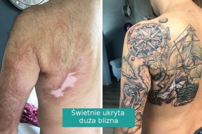 Przy pomocy tatuaży i kreatywności zamienili blizny w dzieła sztuki