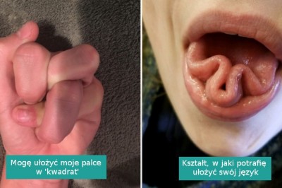 18 zdjęć pokazujących, jak zdumiewające potrafi być ludzkie ciało