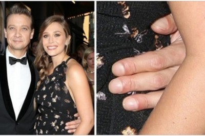 10 gwiazd, których drobne niedoskonałości są niemalże niedostrzegalne dla widzów