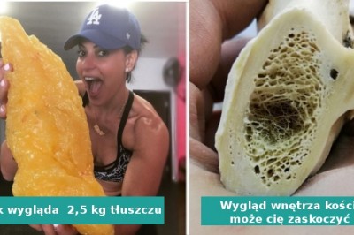 14 zdjęć, które ukazują ludzkie ciało z innej perspektywy i faktycznie zaskakują