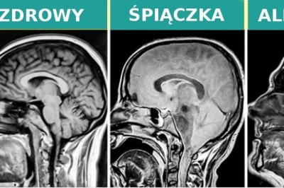16 zdjęć rentgenowskich, które pokazują więcej niż książki do anatomii