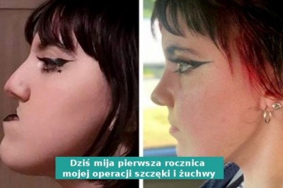 16 osób, które odważyły się na operację plastyczną i  trafiły w dziesiątkę