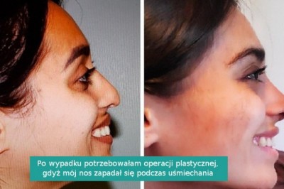 14 osób, które włożyły sporo wysiłku żeby zmienić się nie do poznania