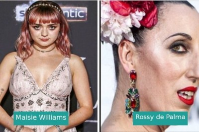 Te gwiazdy i celebrytki nie przejmują się standardami piękna narzucanymi przez społeczeństwo