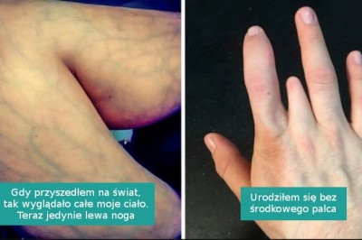 15 unikalnych cech wyglądu, które pokazują jak niezwykłe potrafi być ludzkie ciało