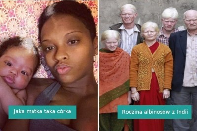 Ci ludzie wygrali na loterii genetycznej i swoim wyglądem zaskakują