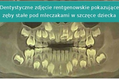 14 zdjęć rentgenowskich odkrywających niewidzialną stronę naszego świata