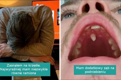 17 zdjęć unikalnych osób, które pokazują, że geny bywają nieprzewidywalne