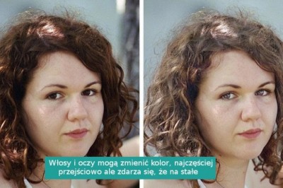 8 zmian zachodzących w ciele kobiety po urodzeniu dziecka. Niektóre są negatywne