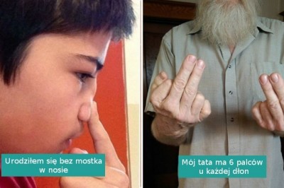 Cechy genetyczne tych ludzi należą do naprawdę rzadkich i wyjątkowych