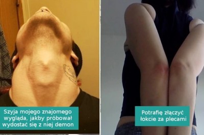 16 osób, których ciała są pełne nietypowych „skarbów”