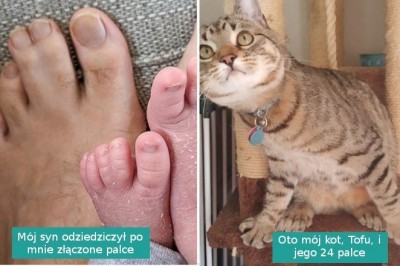 15 fotografii pokazujących, że odmienność to supermoc, której nie trzeba się wstydzić